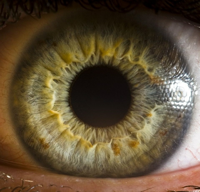 Оцветяване на очите, което означава око