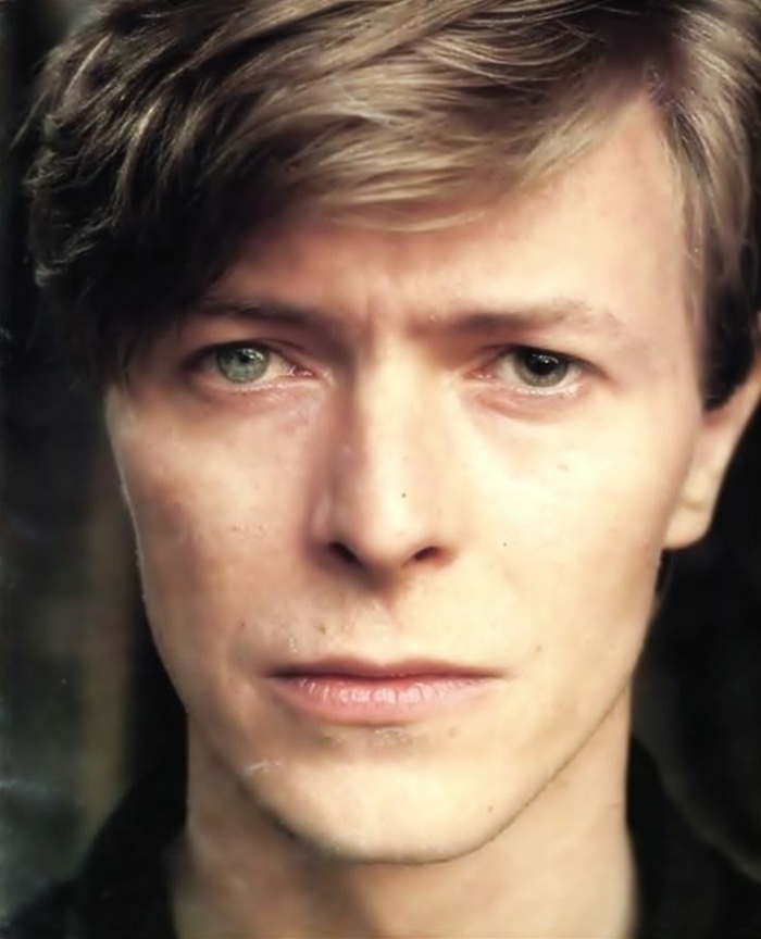 David Bowie ojos heterochromia